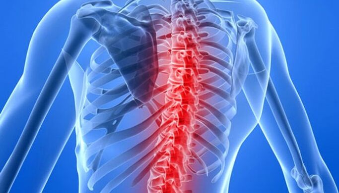 Les pathologies de la colonne vertébrale sont les causes les plus fréquentes de maux de dos au niveau de l'omoplate