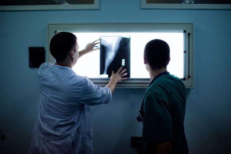 Diagnostic d'arthrose sur le rayon x