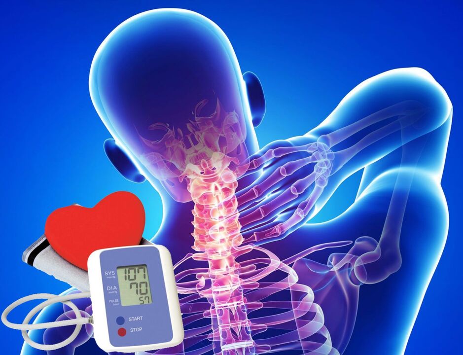 Sauts de tension artérielle avec ostéochondrose cervicale