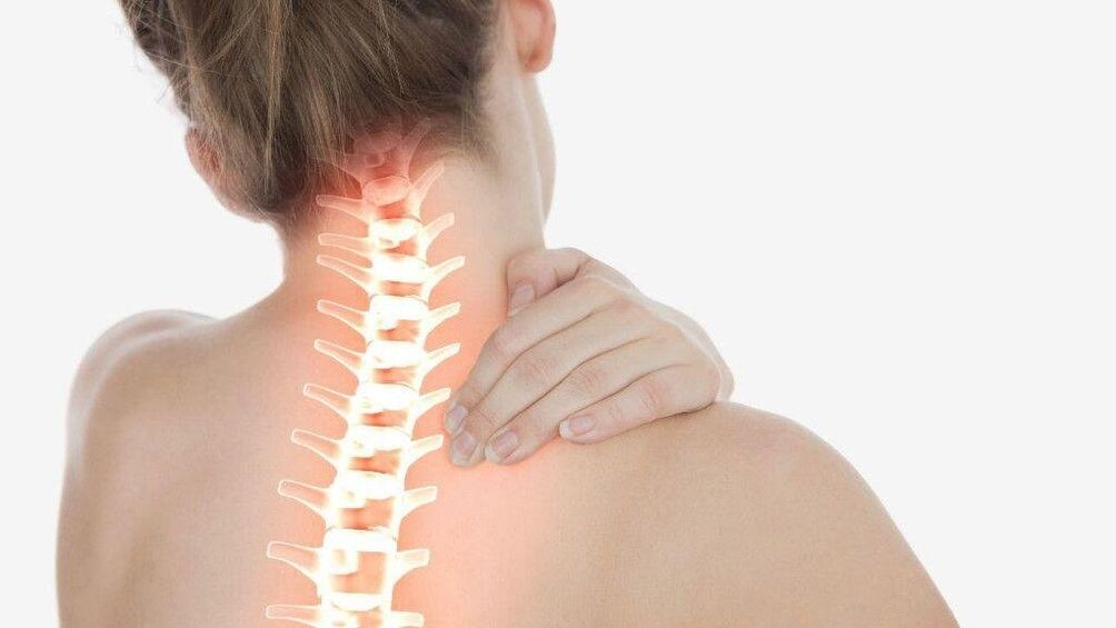 Avec l'ostéochondrose de la colonne cervicale, un syndrome radiculaire peut se développer