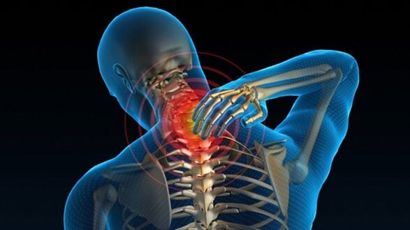 Une douleur en tournant le cou peut indiquer un syndrome d'ostéochondrose vertébrale cervicale